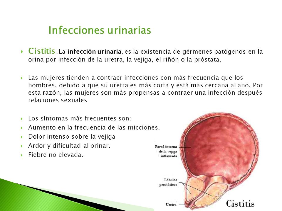 Duele la espalda la esfera de la espátula izquierda